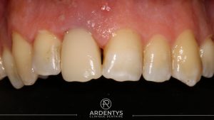 Réhabilitation unitaire