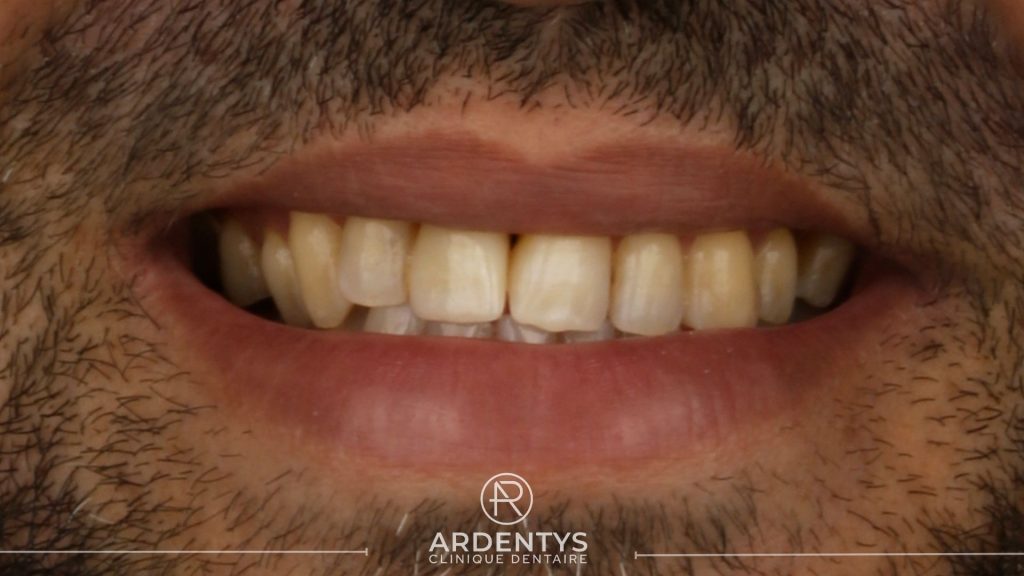 Réhabilitation unitaire