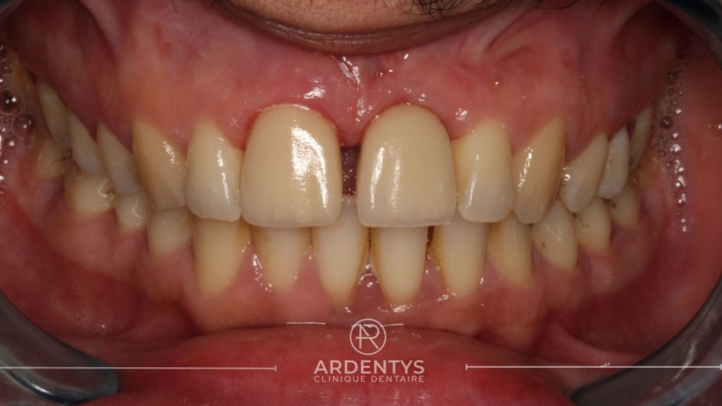 Réhabilitation unitaire