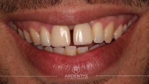 Réhabilitation unitaire