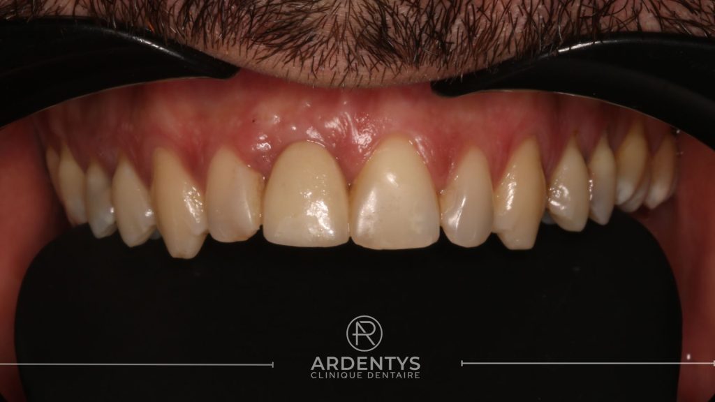 Réhabilitation unitaire