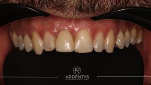 Réhabilitation unitaire