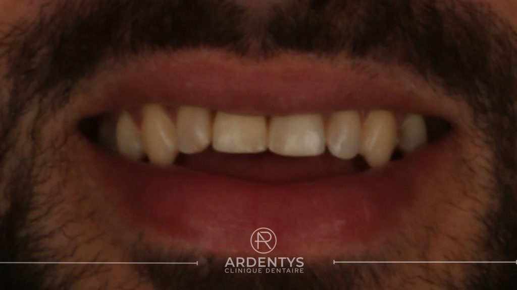 Réhabilitation unitaire