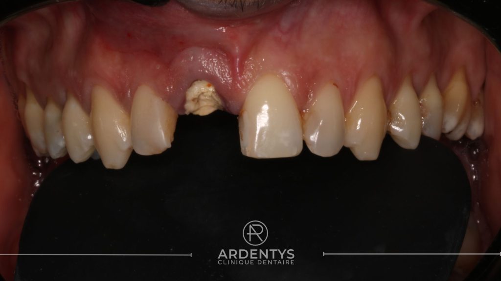 Réhabilitation unitaire