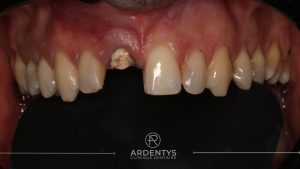 Réhabilitation unitaire