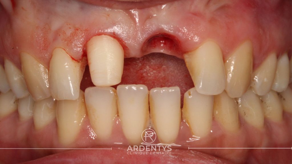 Réhabilitation unitaire