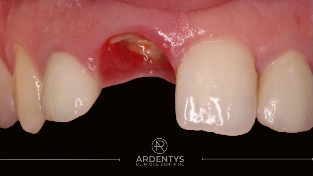 Réhabilitation unitaire