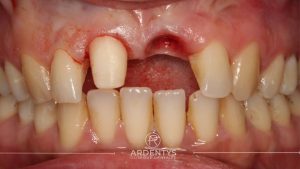 Réhabilitation unitaire