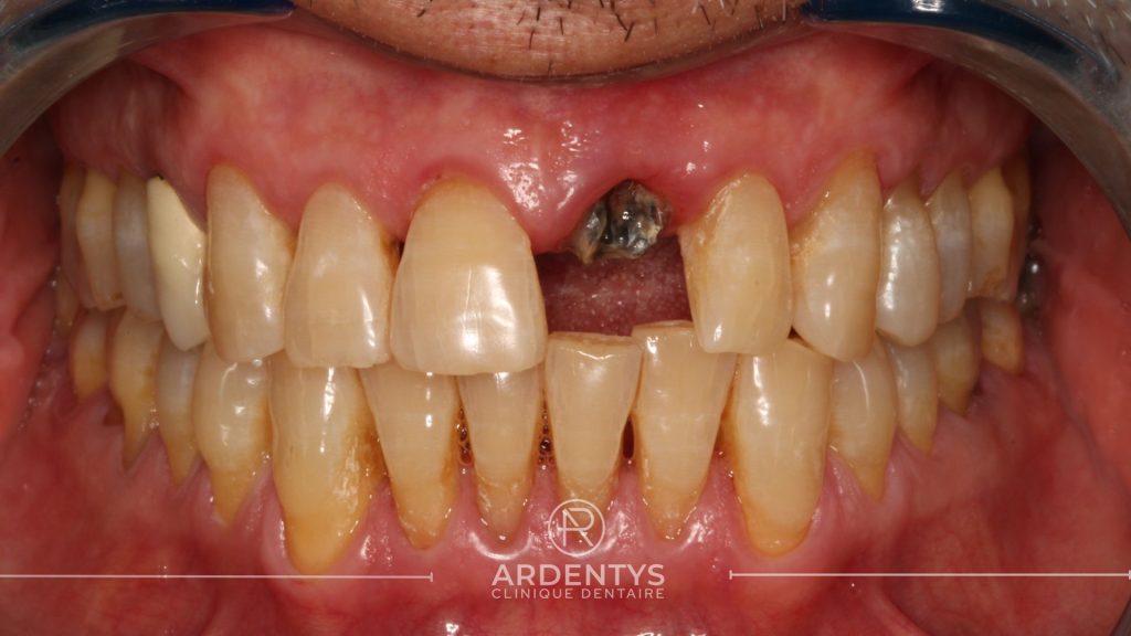 Réhabilitation unitaire