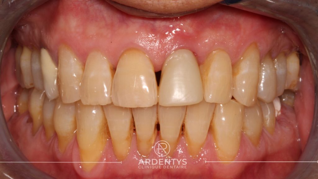 Réhabilitation unitaire