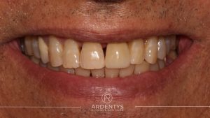 Réhabilitation unitaire