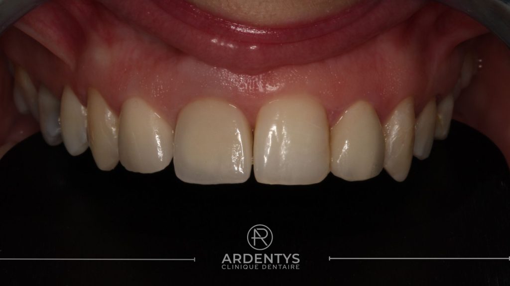 Réhabilitation unitaire