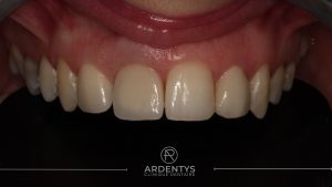 Réhabilitation unitaire