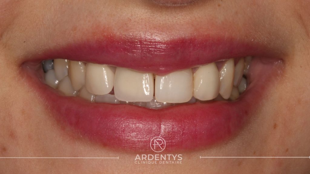 Réhabilitation unitaire