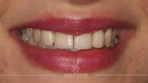 Réhabilitation unitaire