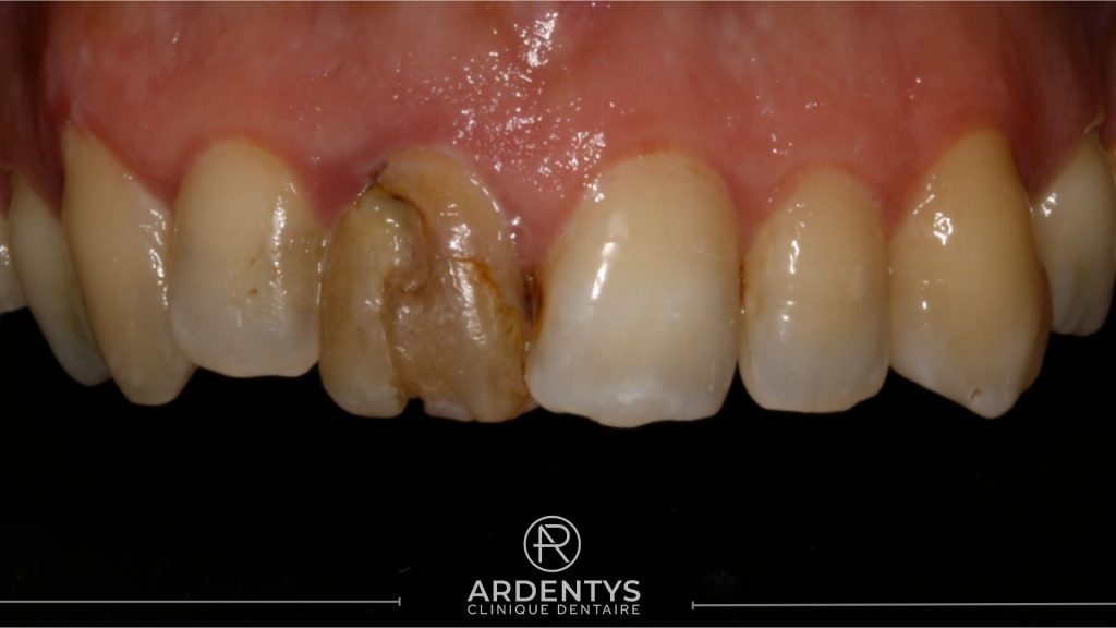 Réhabilitation unitaire