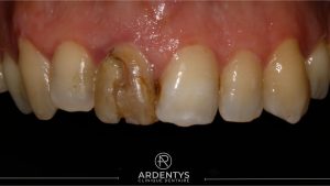 Réhabilitation unitaire