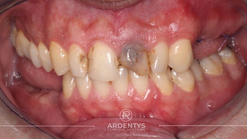 Réhabilitation unitaire