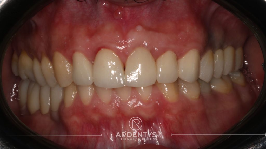 Réhabilitation unitaire