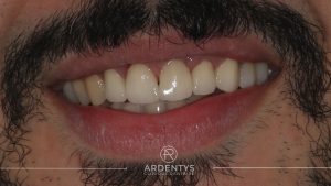 Réhabilitation unitaire