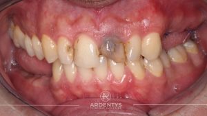 Réhabilitation unitaire