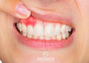 Pathologie buccodentaire