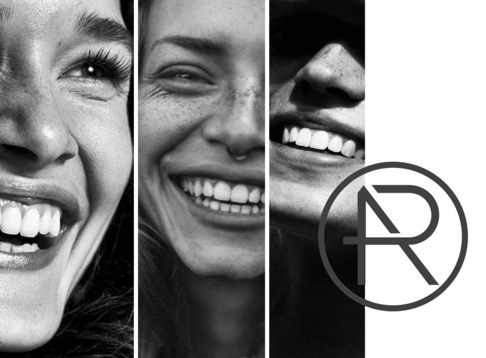 Facettes dentaires