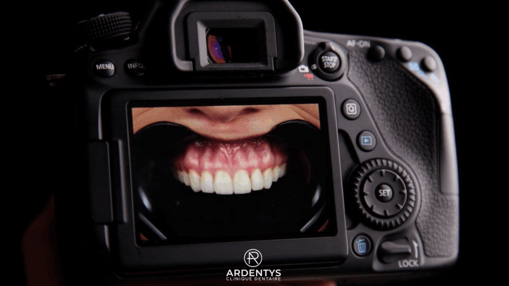 La photographie dentaire, un atout moderne