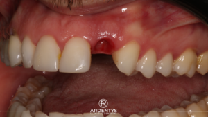 Réhabilitation unitaire