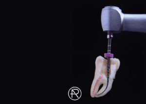 Odontologie Conservatrice Endodontie