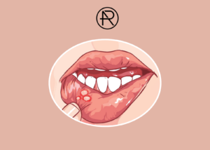 Pathologie buccodentaire