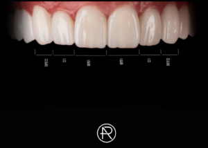 Digital Smile Design – DSD