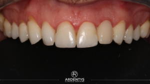 Réhabilitation unitaire