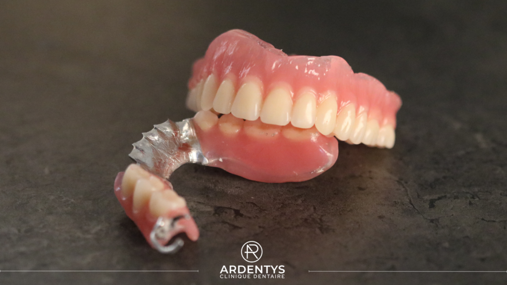 Prothèses Dentaires